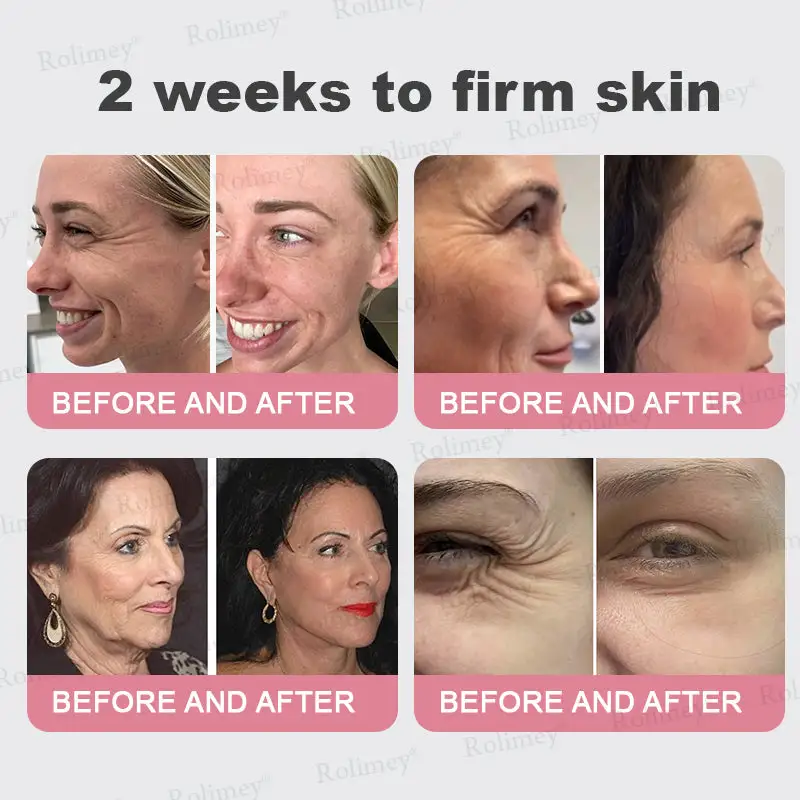 Bio-Botox PDRN Collagen Wrinkle Stick - Image 6