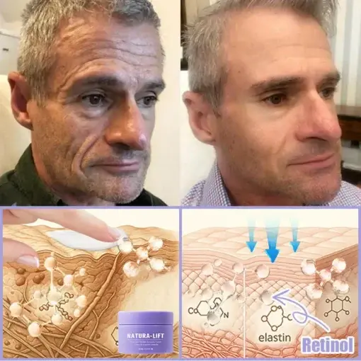 NATURA-LIFT Overnight Wrinkle Recovery Cream - Image 6