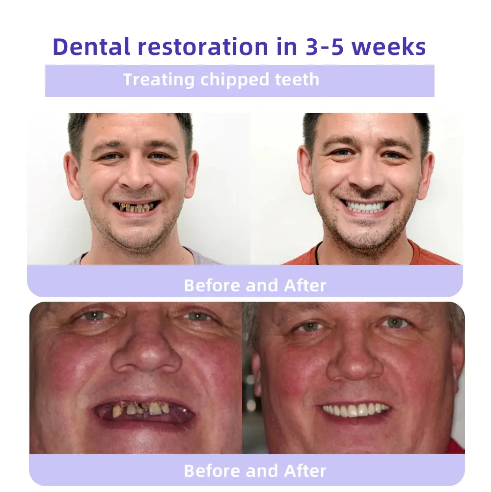 New Oyikey™ TeethRestoration Mineral Powder - Image 9