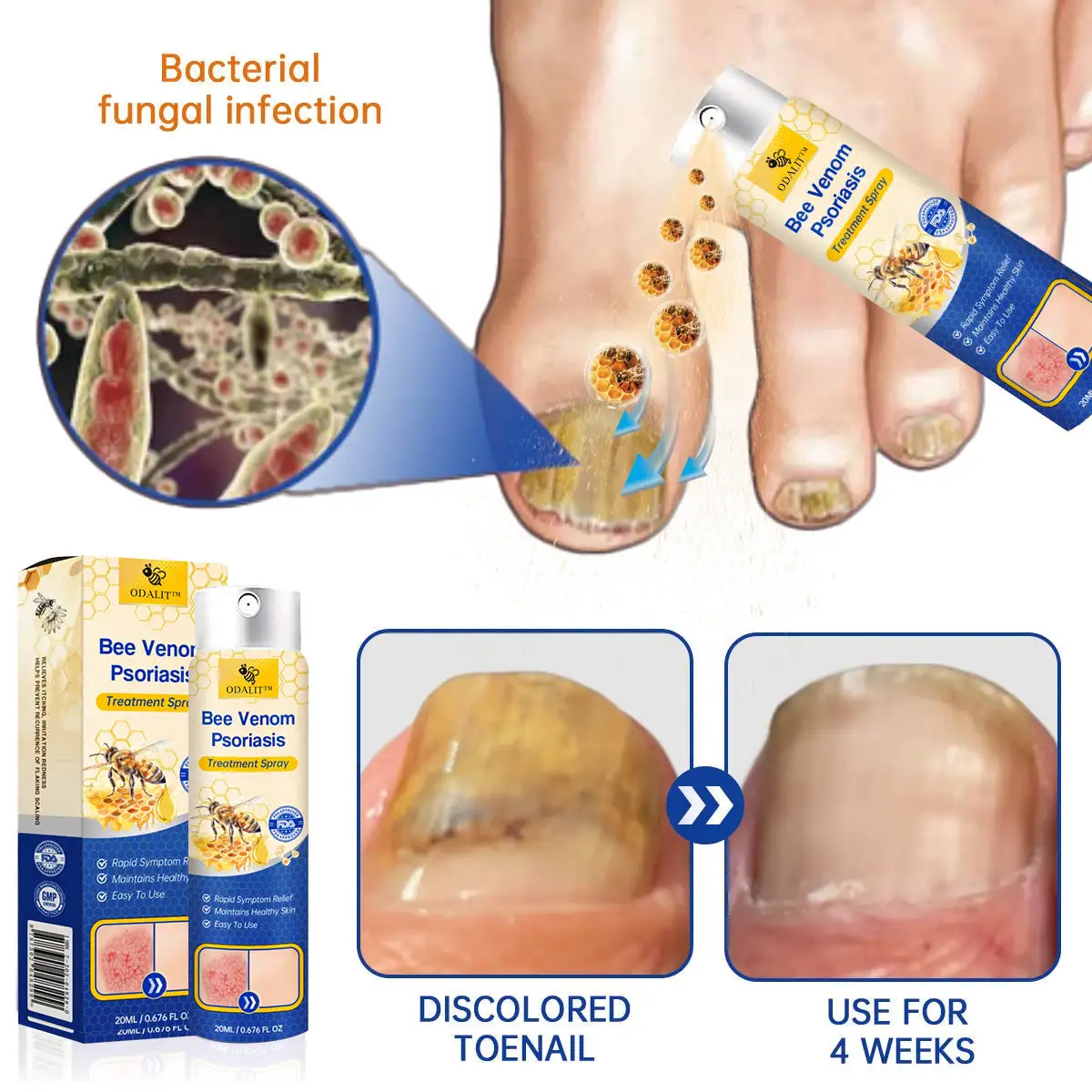 PsoriaHeal psoriasis Spray - Image 11