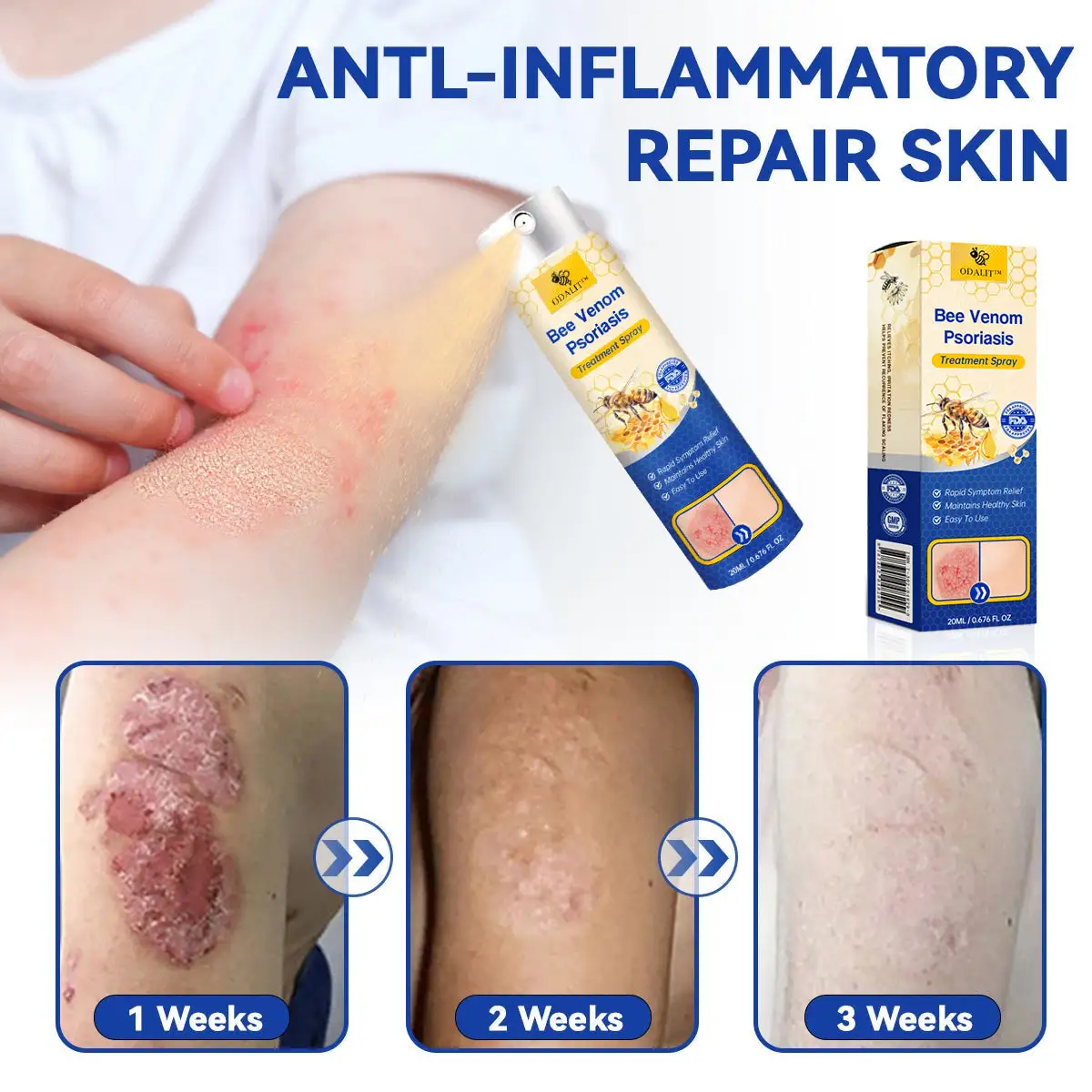 PsoriaHeal psoriasis Spray - Image 7