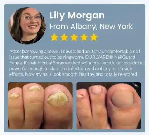 NailGuard Fungal Repair Herbal Spray - Image 11