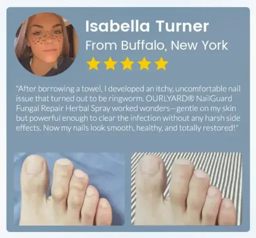 NailGuard Fungal Repair Herbal Spray - Image 13