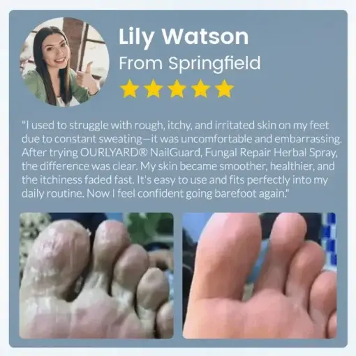 NailGuard Fungal Repair Herbal Spray - Image 14