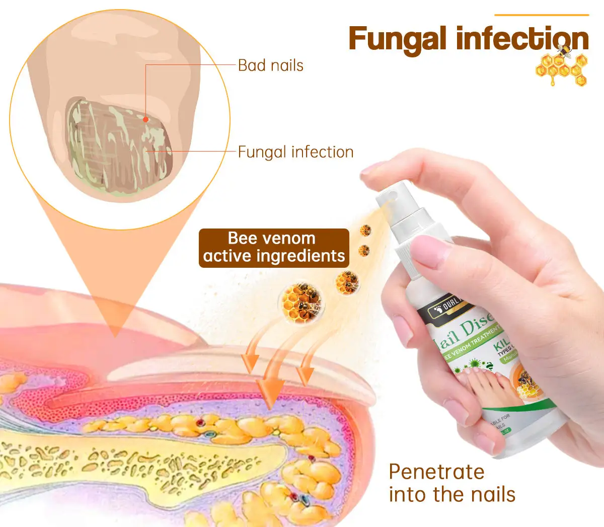 Bee Venom Nail Disease Treatment Spray - Image 2