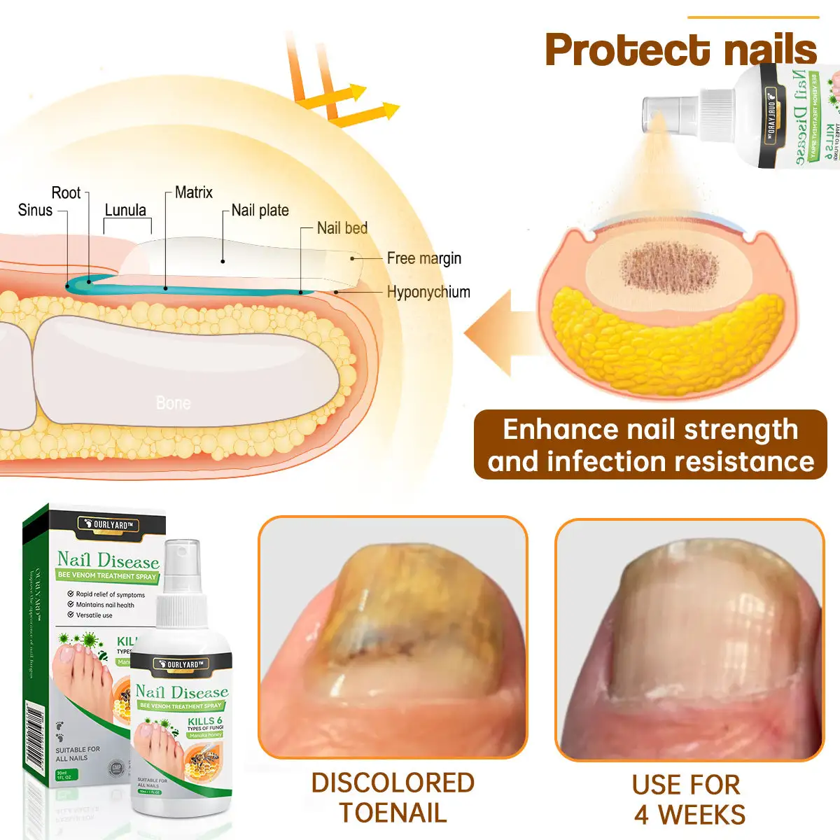 Bee Venom Nail Disease Treatment Spray - Image 4