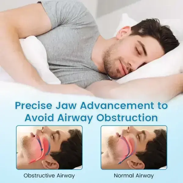 Anti-Snoring & Anti-Grinding Teeth Protector - Image 6