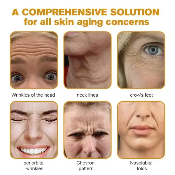 Special Discount Botox Bee Venom Wrinkle Removal Cream - Image 2