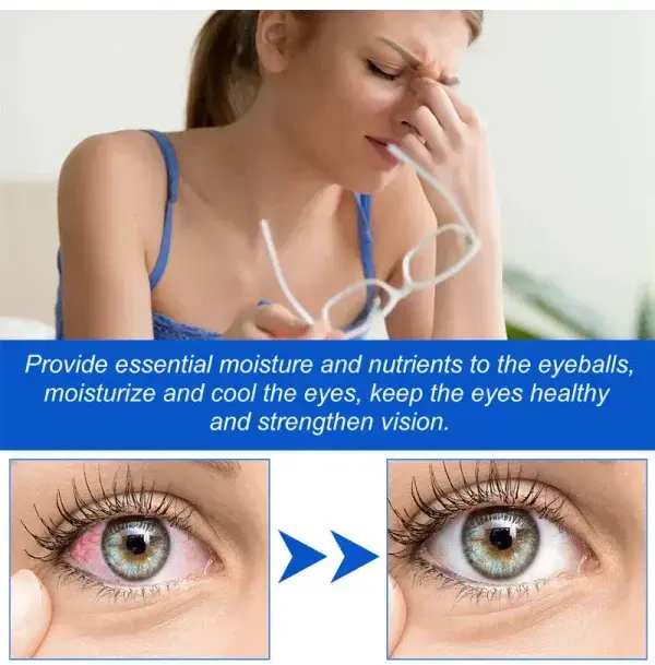 Vision recovery eye drops - Image 9
