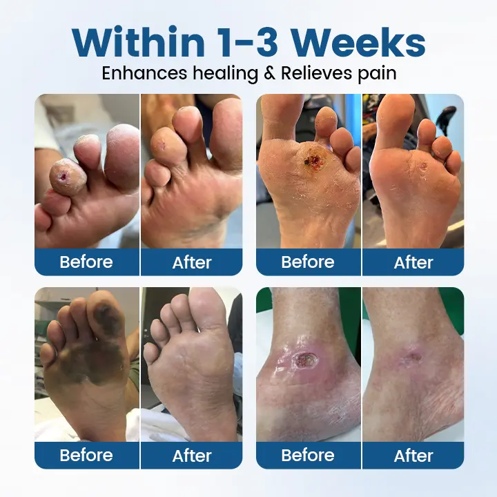 AngioVita Diabetic Care Spray - Image 4