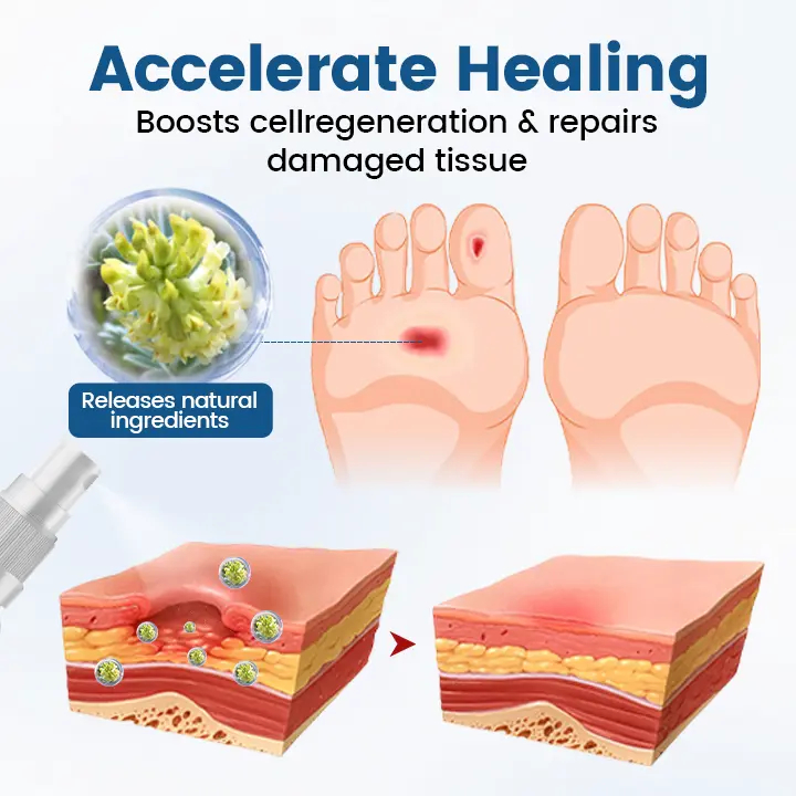 AngioVita Diabetic Care Spray - Image 7