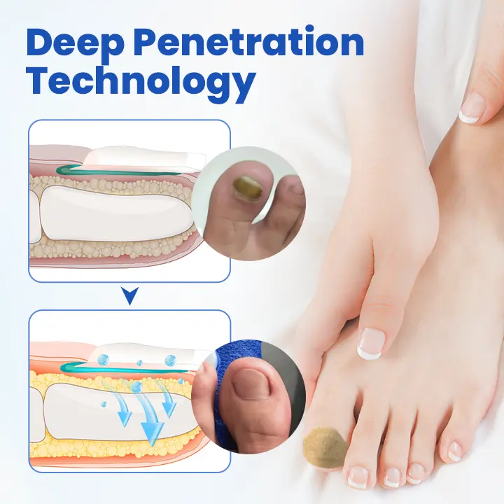 FungalPatch - Antibacterial Fungal Patch - Image 3