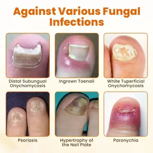 FungiBee Advanced Nail Repair Spray - Image 8