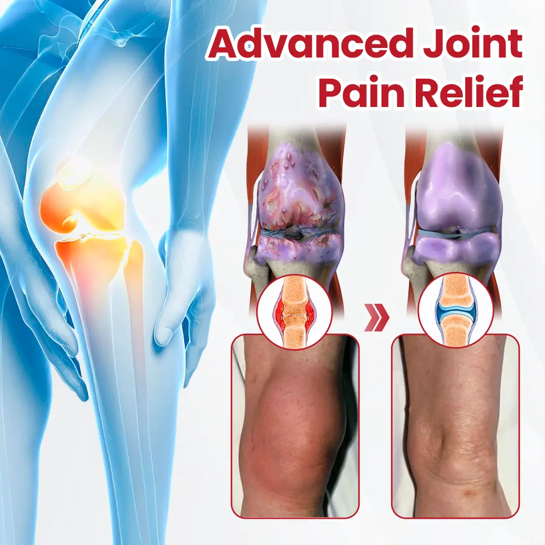 HorseEase Joint Relief Cream - Image 4