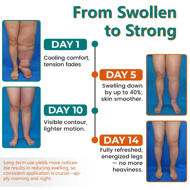 LymphoEase Magnesium Roll-On Relief Cream - Image 5