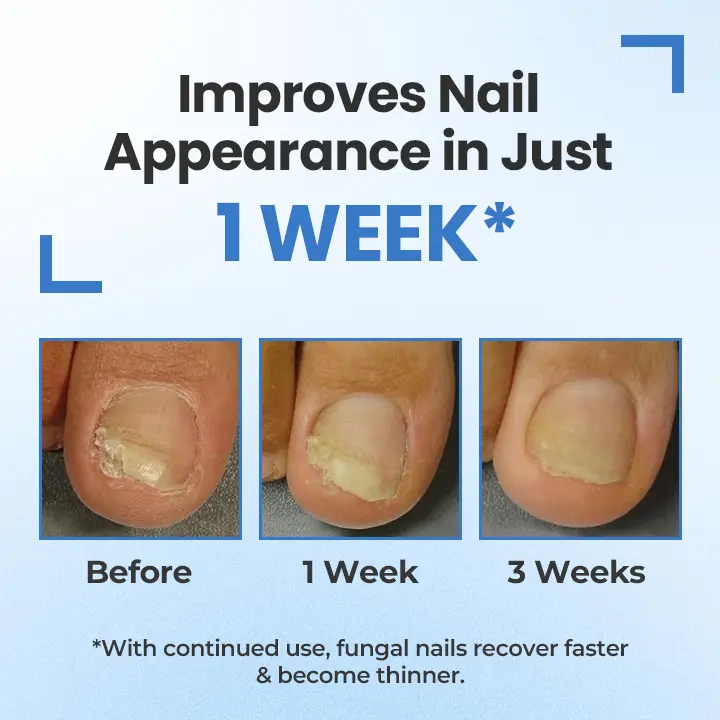 MycoErase Nail Revive Pen - Image 9