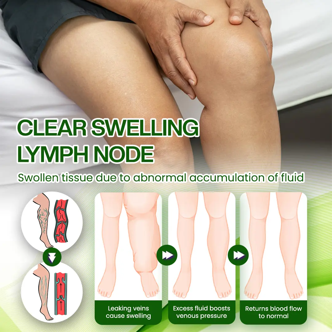 SwellRelief Horse Chestnut Edema Cream - Image 8