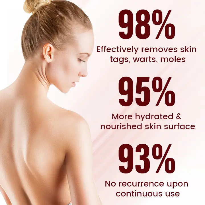 Vionara Nano WartErase Patch - Image 6