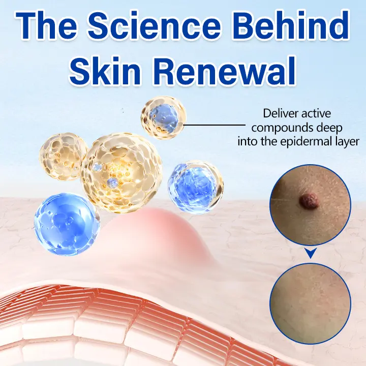 WartClear Herbal Ointment - Image 5