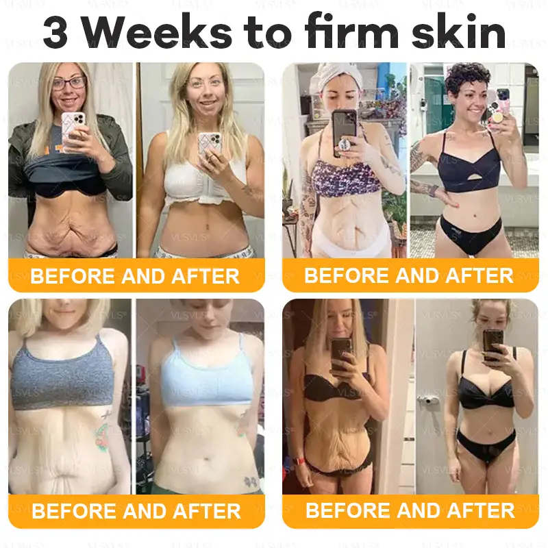 Bee Venom Skin Restoration Cream LAST DAY 80% OFF - Image 2