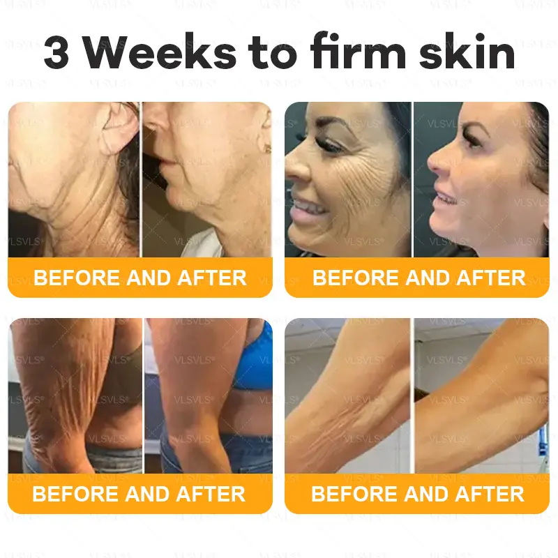 Bee Venom Skin Restoration Cream LAST DAY 80% OFF - Image 4