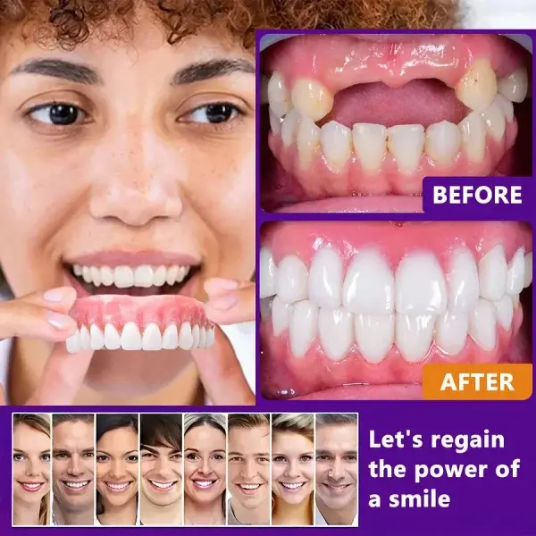 Advanced Customized Full Denture Set - Image 13