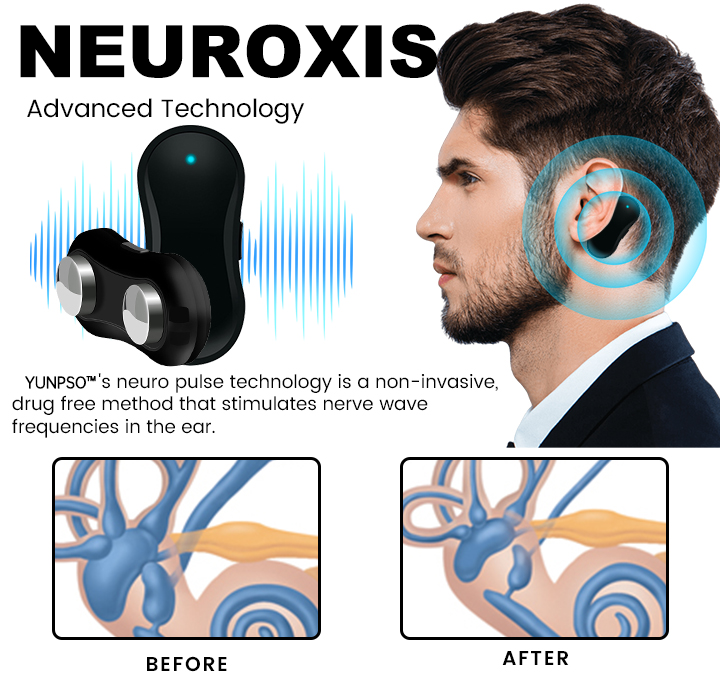 Tinnitus Relief Device Serenity - Image 8