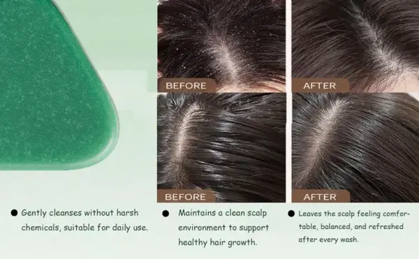 ๐๐๐ญ๐ ๐๐ข๐ซ๐ณ๐ ๐๐๐๐๐ซ๐ฏ๐๐ฌ๐๐๐ง๐ญ ๐ญ๐๐๐ฅ๐๐ญ๐ฌ - Image 5