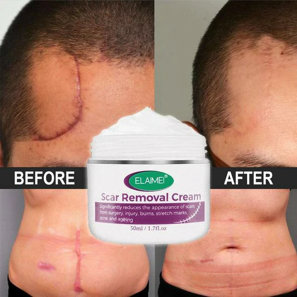 🔥Organic Skin Rebound Cream - Image 6