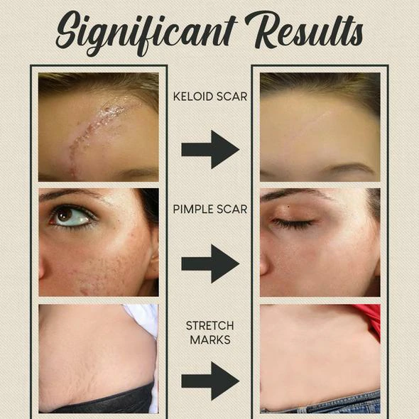 🔥Organic Skin Rebound Cream - Image 5