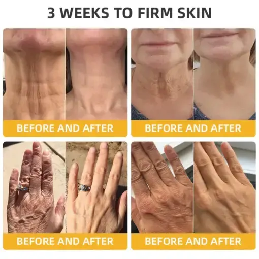 ๐๐๐๐ ๐๐๐+ ๐๐๐ ๐๐ง๐๐ซ๐๐ญ๐ข๐ฏ๐ ๐๐๐ฉ๐๐ข๐ซ ๐๐จ๐ญ๐ข๐จ๐ง - Image 3