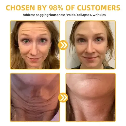 ๐๐๐๐ ๐๐๐+ ๐๐๐ ๐๐ง๐๐ซ๐๐ญ๐ข๐ฏ๐ ๐๐๐ฉ๐๐ข๐ซ ๐๐จ๐ญ๐ข๐จ๐ง - Image 6