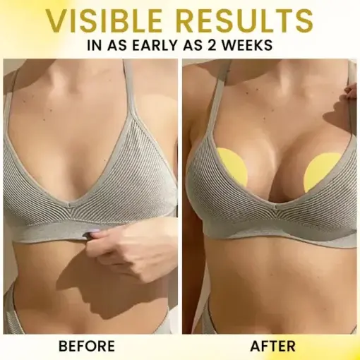 Apex-Lift Volumizing & Lifting Microneedle Bust Patch - Image 4