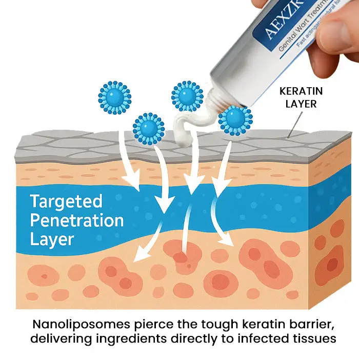 HPV Genital Wart Treatment Cream - Image 5
