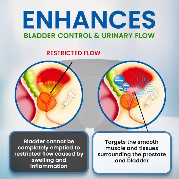 Prostate Ionic Underwear - Image 5
