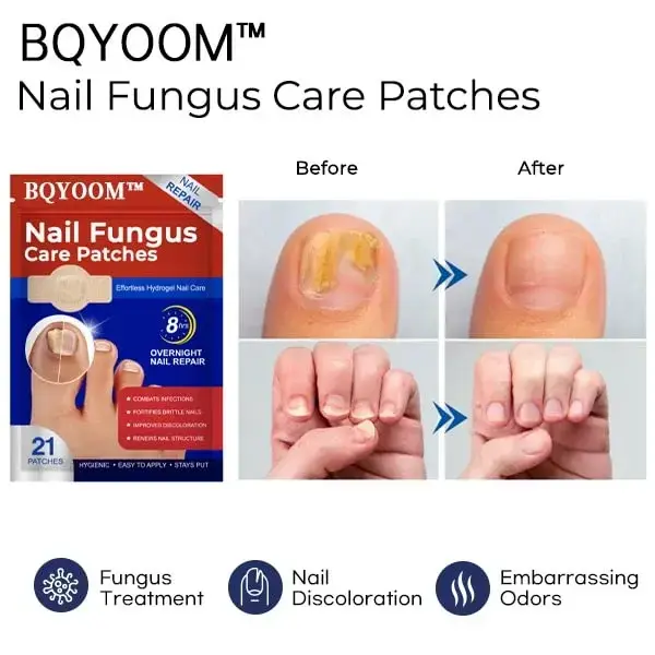Nail Fungus Care Patches - Image 2