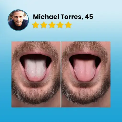 Tongue Coating Cleaning Gel - Image 2