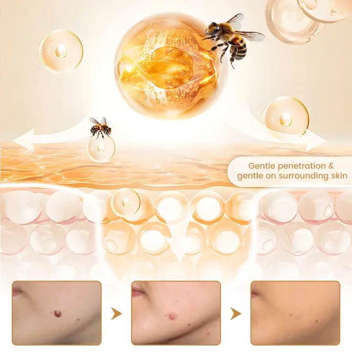 BeeVenom Wart Drop Serum - Image 7