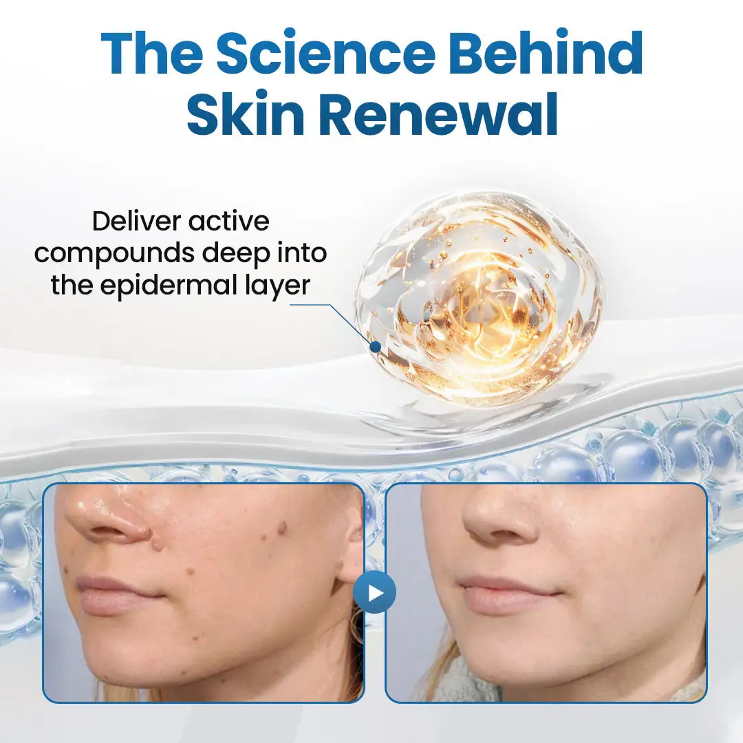 BumpFlatten Cream - Image 3