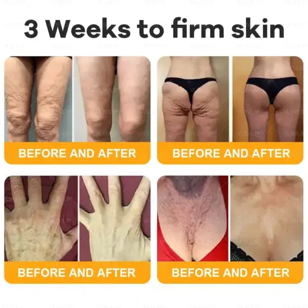 Bee Venom Skin Restoration Cream - Image 4