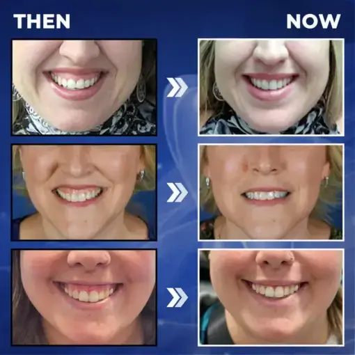 ApiGuard BeeVenom Therapeutic Oral Drops & Rinse - Image 5