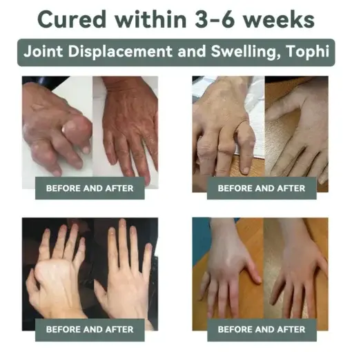 Nerve Repair &Pain Relief Magnesium Cream - Image 4