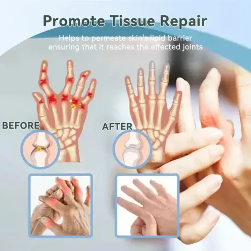 Nerve Repair & Pain Relief Magnesium Cream - Image 5