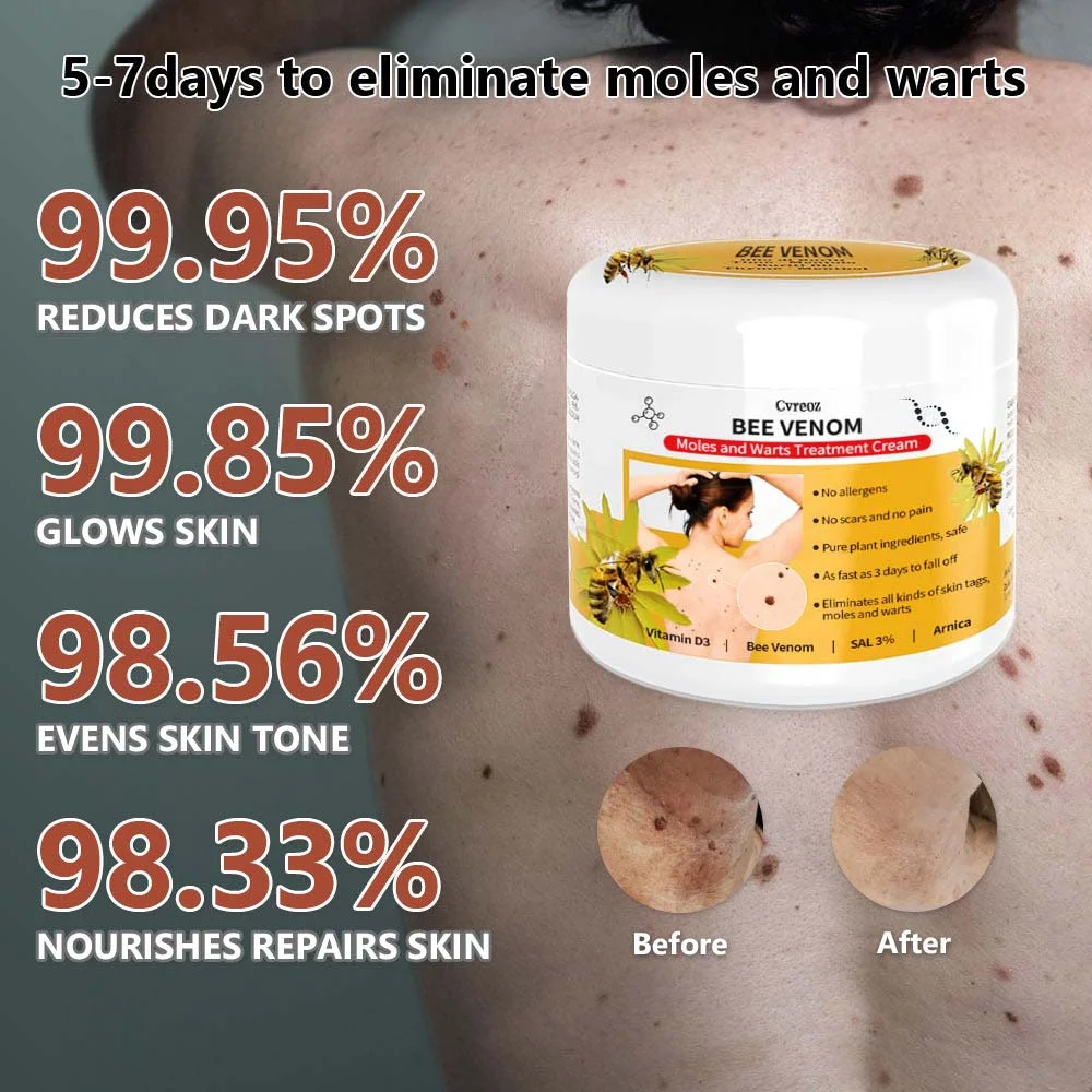 PRO Bee Venom Mole and Wart Treatment Cream - Image 3