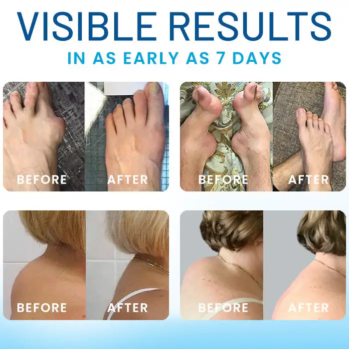 Joint Relief TB-500 Microneedle Patch - Image 6