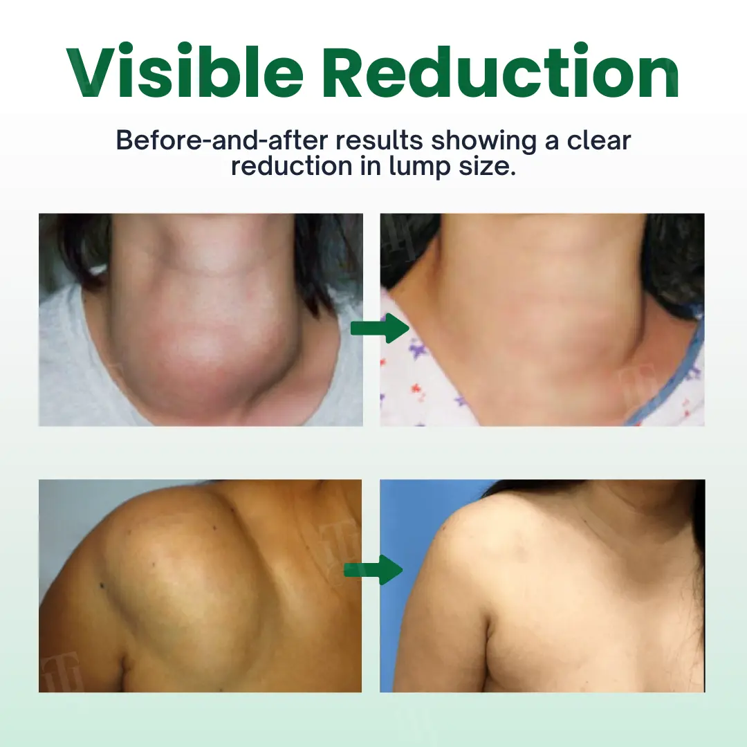 Knot-X Lipoma Dissolve Cream - Image 2