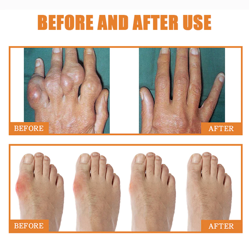 Bee Venom Vitamin D Arthritis Joint Pain Relief Spray - Image 4