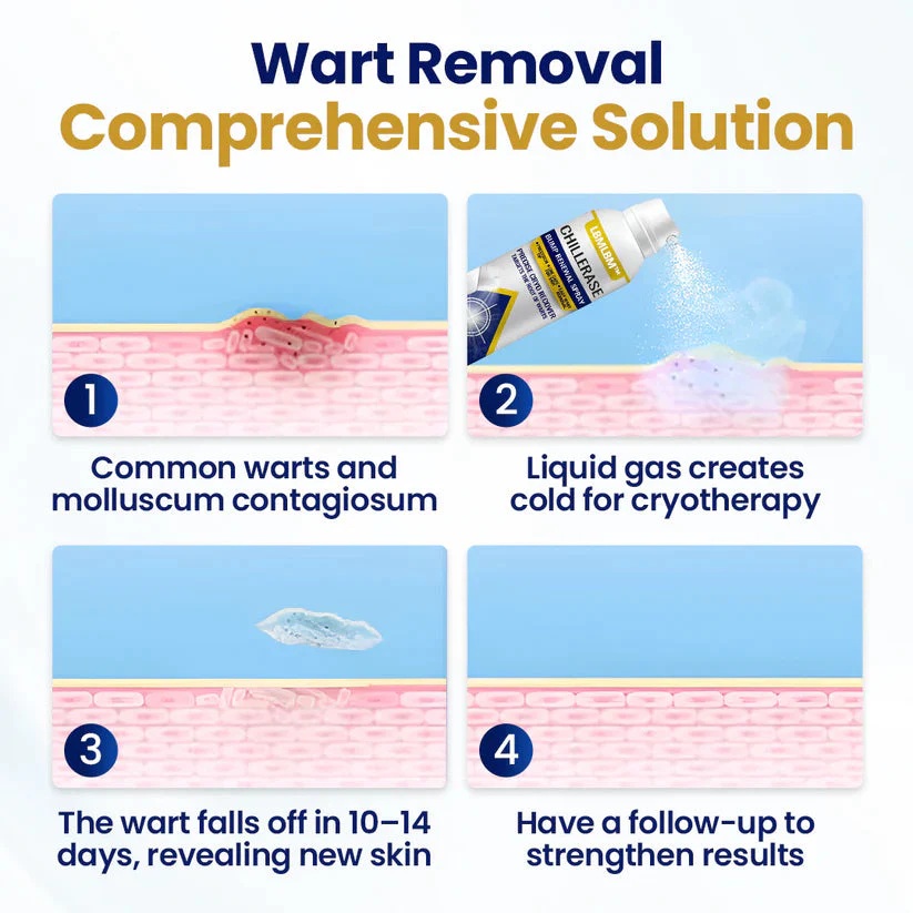 ChillErase Bump Renewal Spray - Image 4