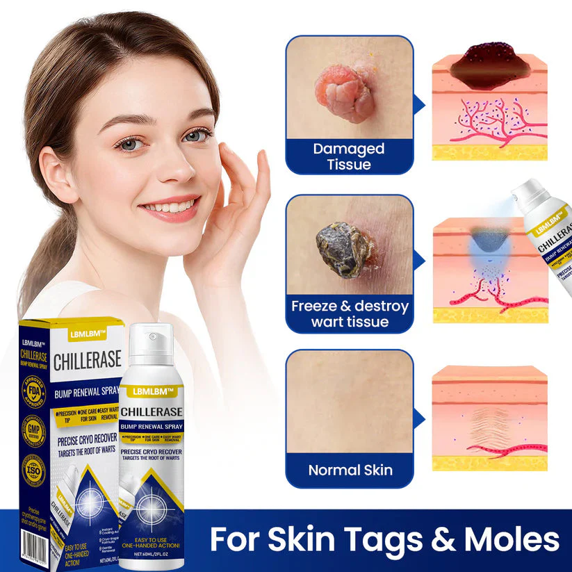 ChillErase Bump Renewal Spray - Image 2