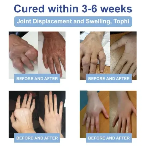 Black Rice Pain Healing Bone Cream - Image 14